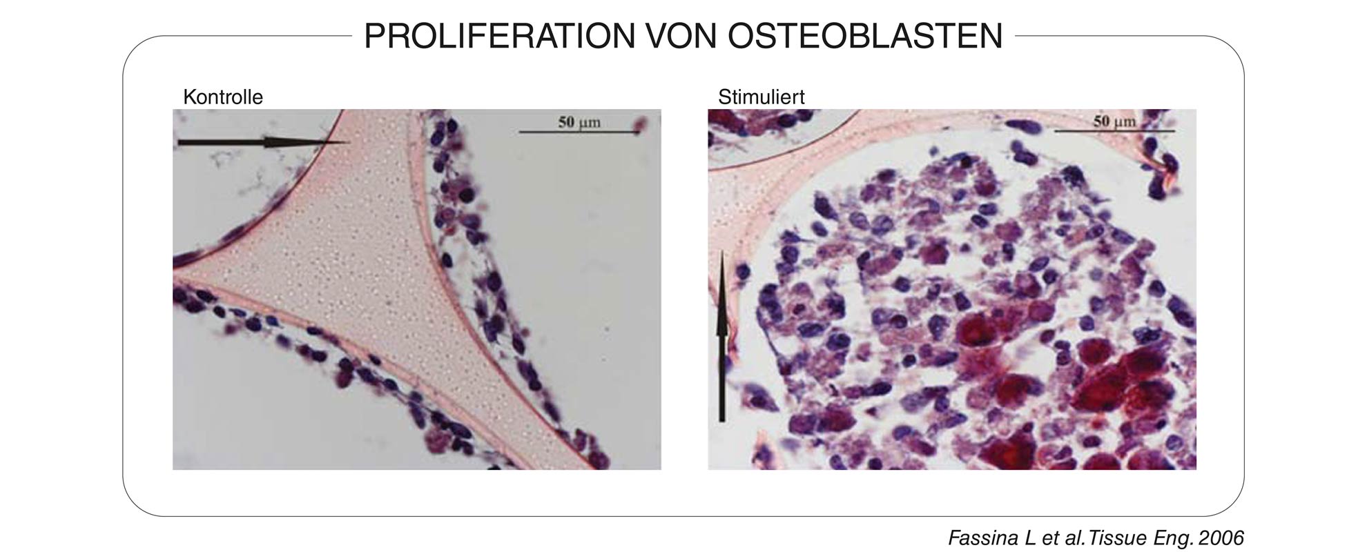 Proliferation von Osteoblasten